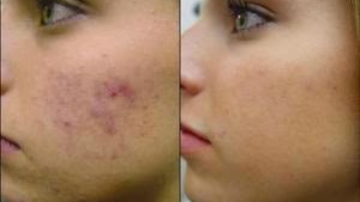 10-Mind-Blowing-Reasons-Why-Aloe-Vera-Is-A-Miracle-Plant-8