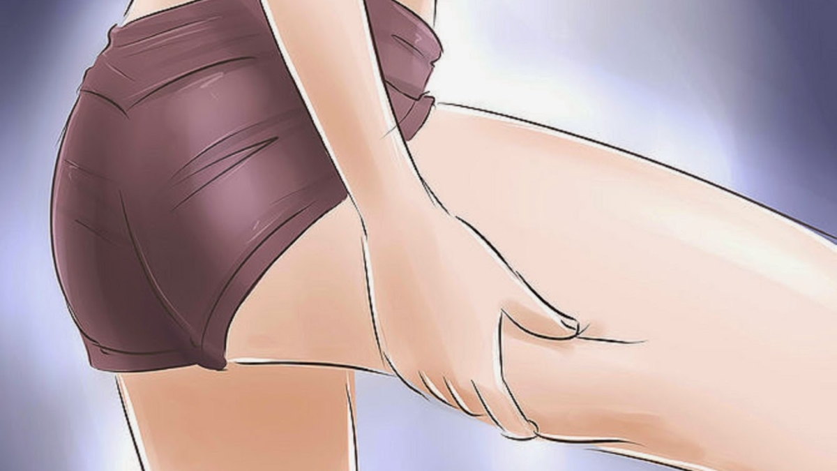 Lalistedesalimentsquiproduisentlacellulite