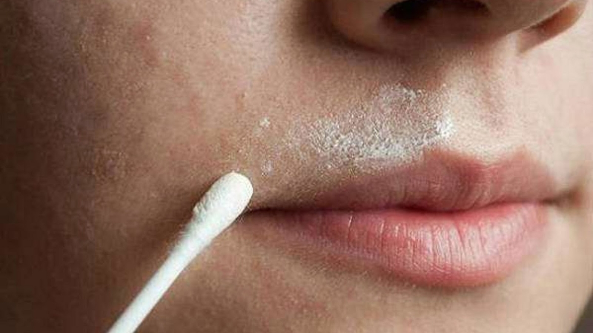 RemC3A8demaisonefficacepourenleverrapidementlespoilsindC3A9sirables1