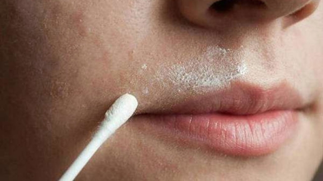 RemC3A8demaisonefficacepourenleverrapidementlespoilsindC3A9sirables1