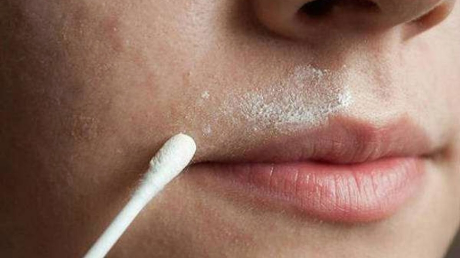 RemC3A8demaisonefficacepourenleverrapidementlespoilsindC3A9sirables1