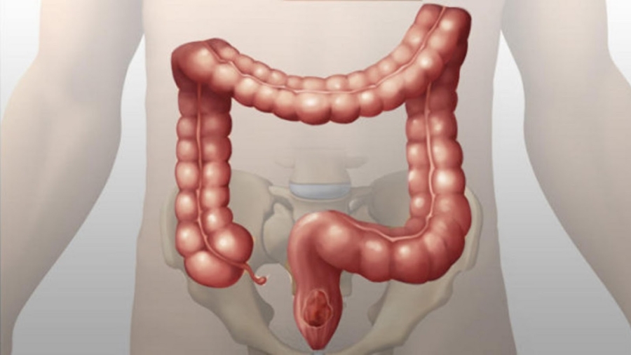 Unecured25C325A9toxifianteexcellentepournettoyezfacilement5kilosdepoisonsquevousavezdansvotrec25C325B4lon