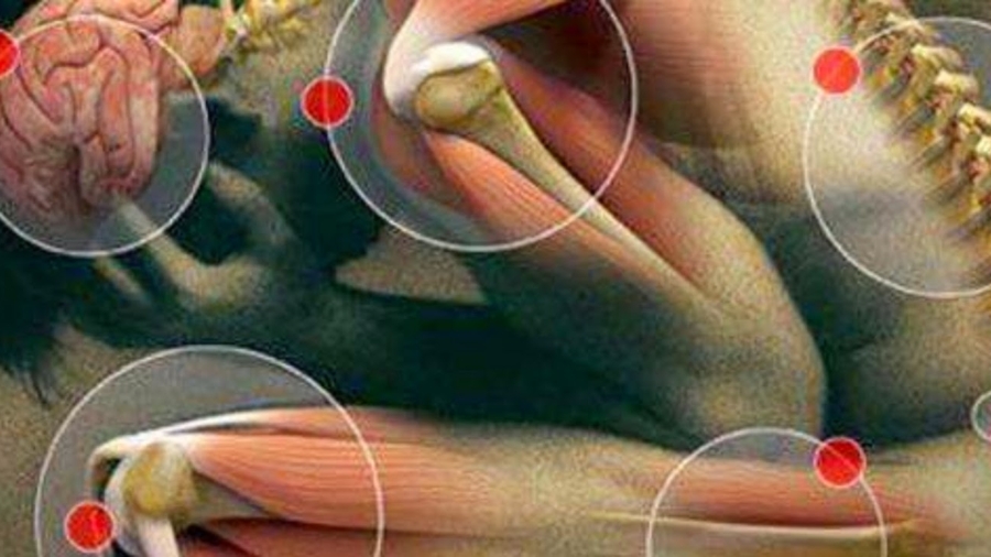 UntrC3A9sordelanatureDesfruitsauxpouvoirsanti-douleursetantiinflammatoiresarticulairespuissants