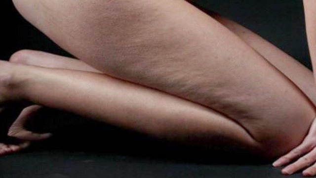 Laboissonquibr25C325BBlelesgraissesetpermetdesed25C325A9barrasserdelaCelluliterapidement