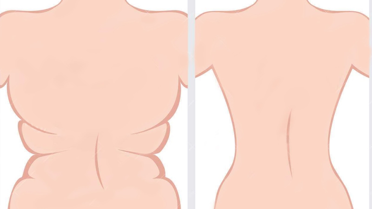 25C32589liminerlagraissedorsaleetobteniruncorpsplusattrayantaveccesexcellentsConseils