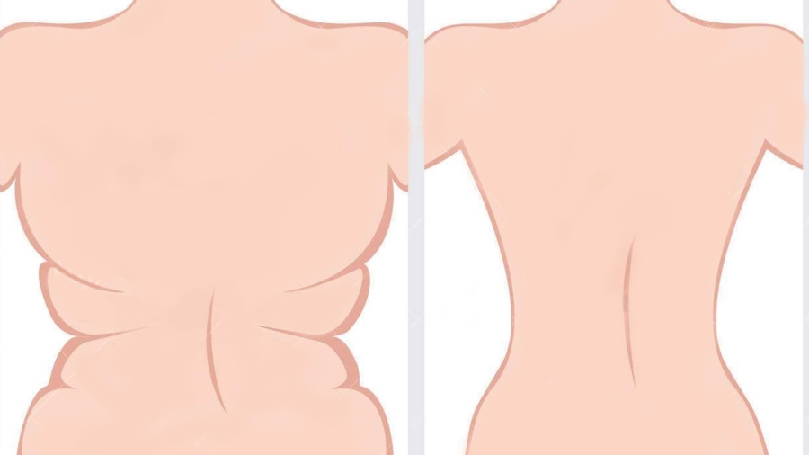 25C32589liminerlagraissedorsaleetobteniruncorpsplusattrayantaveccesexcellentsConseils