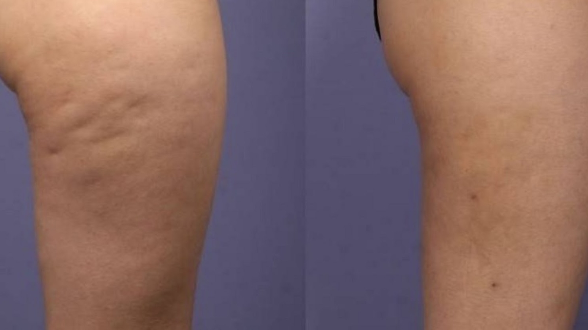 L25E22580259925C325A9picemagiquequivavousaider25C325A0vousd25C325A9barrasserdelapr25C325A9senceG25C325AAnantedelacellulite