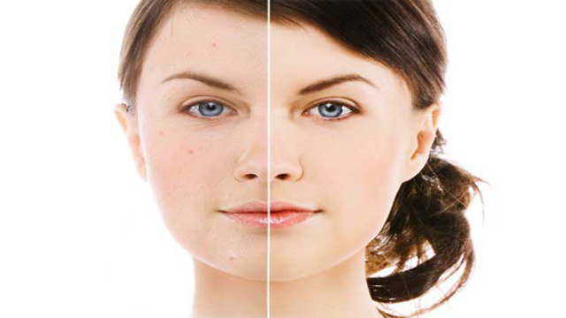 Perdrelesd25C325A9p25C325B4tsdegraissedevotrevisageaveccer25C325A9gime