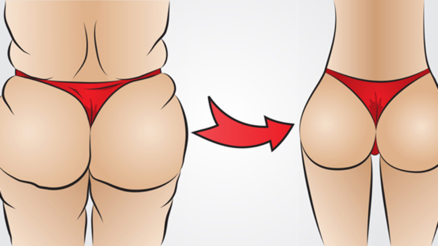 Pourquoivousdevezmarcheretnepascourir252Cvotrefa25C325A7onPourlapertedegraisse2521