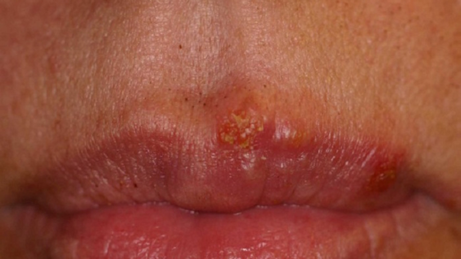 RapidTraitement25C325A0l25C325A8vresherp25C325A8s