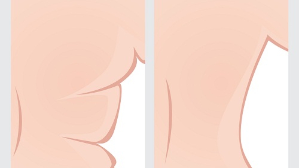 6Exercicespoursed25C325A9barrasserdeSoutien-gorgeGraisse