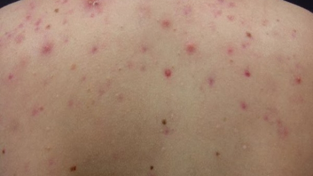 Acn25C325A9surledos5raisonsdeleurapparitionetcommentlestraiter