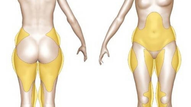 Lisezcetarticlesivousvoulezvousd25C325A9barrasserdelagraissesuppl25C325A9mentairedescertainespartiesdevotrecorps