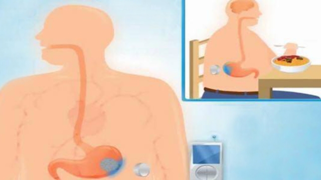 Uneg25C325A9luleconnect25C325A9epourluttercontrel25E225802599ob25C325A9sit25C325A9