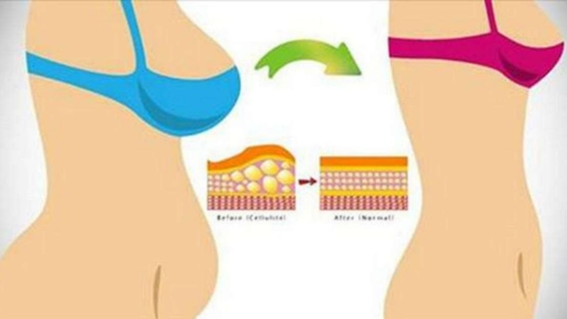 Voicicommentfairepourperdredesgraissesduventrenaturellement