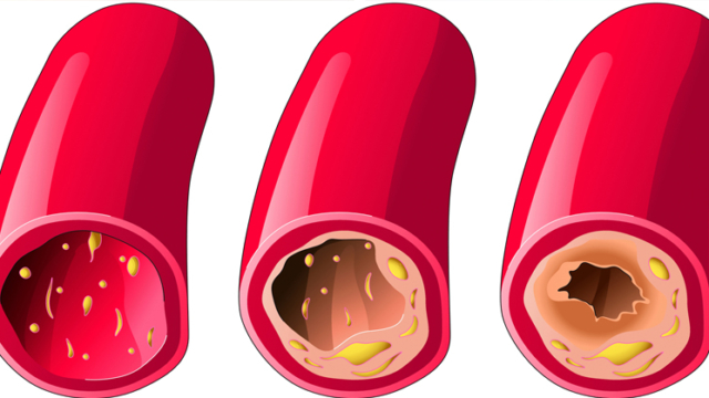 10Foods25263JuicestoLowerCholesterolOxidation10Foods25263JuicestoLowerCholesterolOxidation