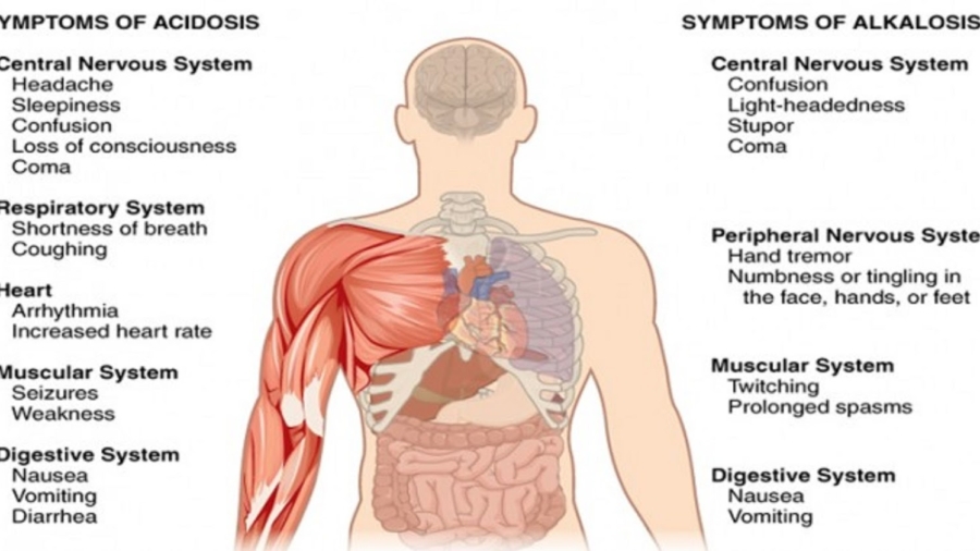 17signesquevotrecorpsesttropacideet9fa25C325A7onsd25E225802599alcaliniservotreorganismeRapidement