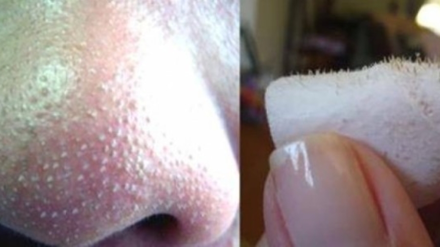 22465c2d6e206cfd15114375a036c1e6.600x