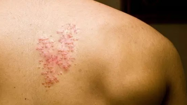 Commenttraiternaturellementlesbardeaux