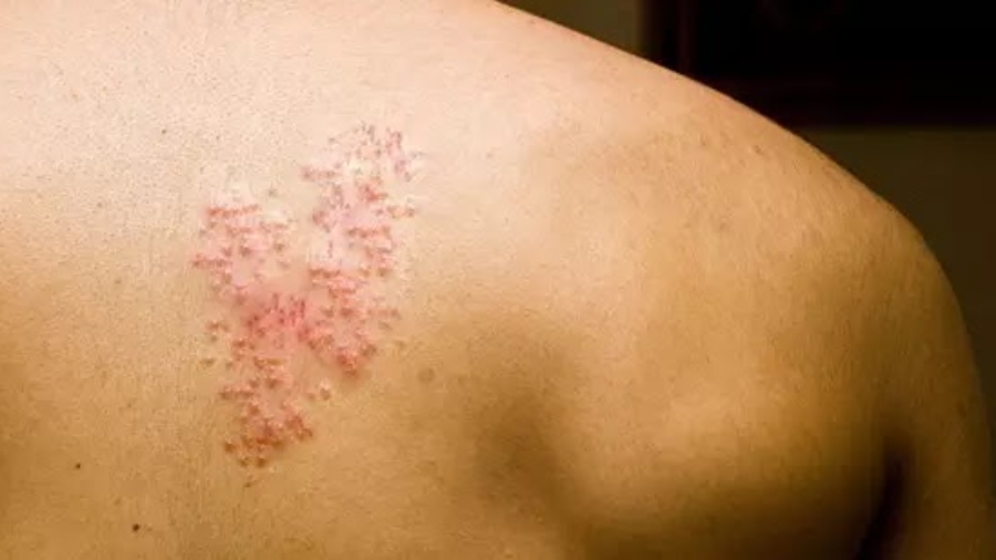 Commenttraiternaturellementlesbardeaux