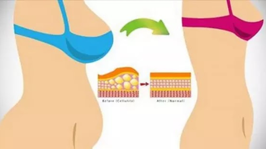 Huitfa25C325A7onssimplespourperdrelagraisseduventresansexercice