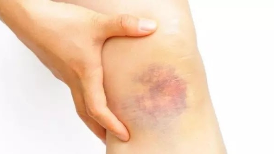 Les20sympt25C325B4mesducancerfemmessontlesplussusceptiblesd2527ignorer