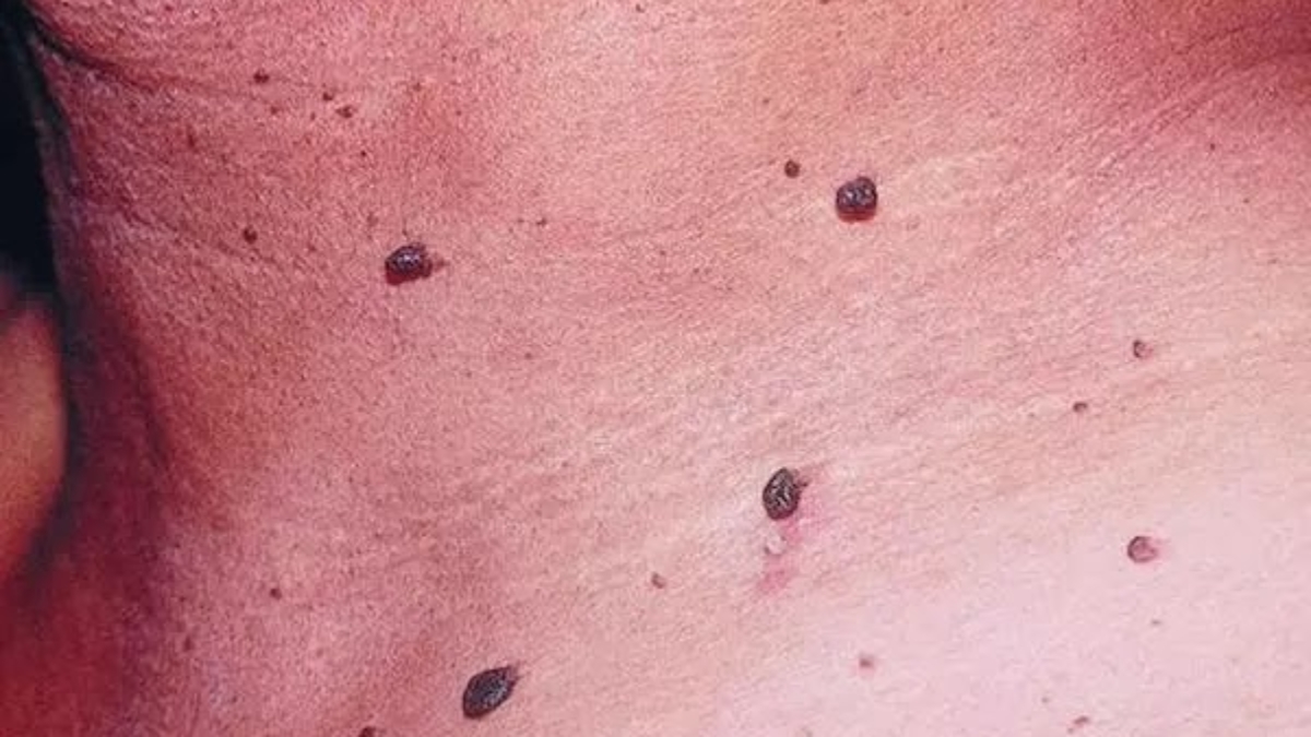 NotreCorpsEnvoieDesSignauxPourDireQueNousNeSontPasSains-NePasLesIgnorer2521