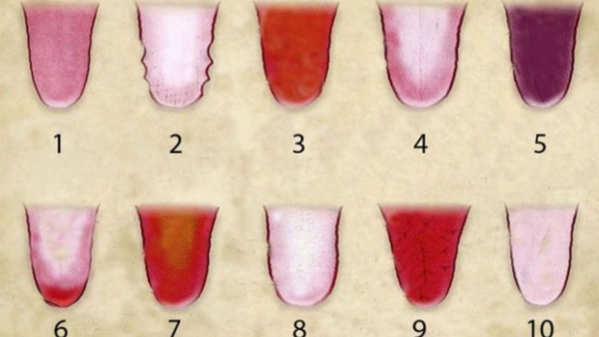 secrets-your-tongue-holds-about-your-health-600x378-1