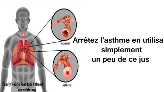 Arr25C325AAtezl2527asthmeenutilisantsimplementunpeudecejus