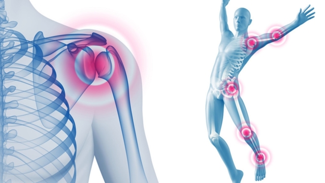 Commentsoignerladouleurdesarticulationsgr25C325A2ceauzesteducitron