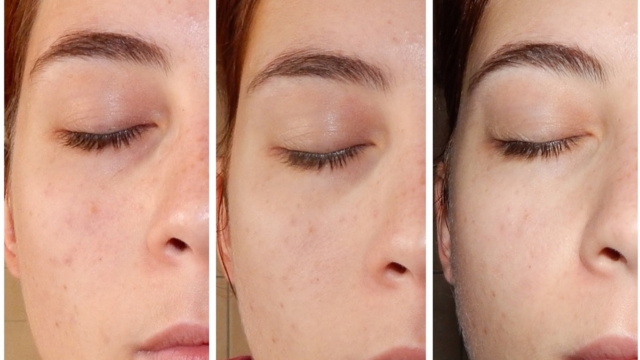 D25C325A9barrasser-vousdescernes252Cdespoches252Cdelafatigueetdemanquedesommeilnaturellement