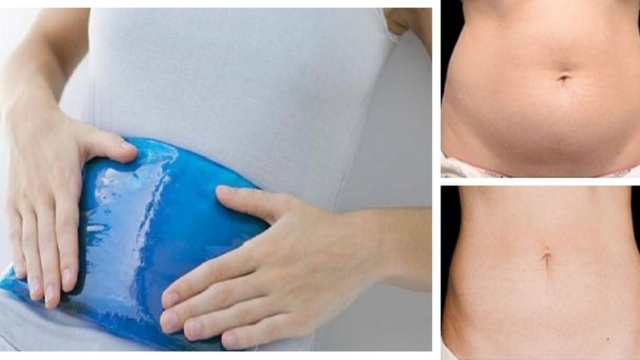 Tuerlescellulesadipeusesinstantan25C325A9mentJusteenlescongelant25212528Vousnecroirezjamaiscommentilfonctionne2529