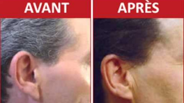 Unrem25C325A8depuissantpour25C325A9liminerlescheveuxblancsetam25C325A9liorelasant25C325A9delapeau