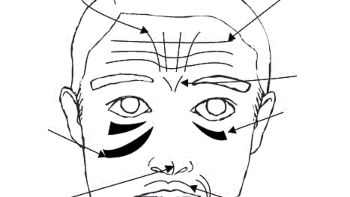 25C225ABFaceMapping25C225BBCommentVotreVisageR25C325A9v25C325A8leVosProbl25C325A8mesDeSant25C325A92521