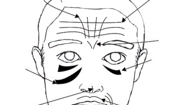 25C225ABFaceMapping25C225BBCommentVotreVisageR25C325A9v25C325A8leVosProbl25C325A8mesDeSant25C325A92521