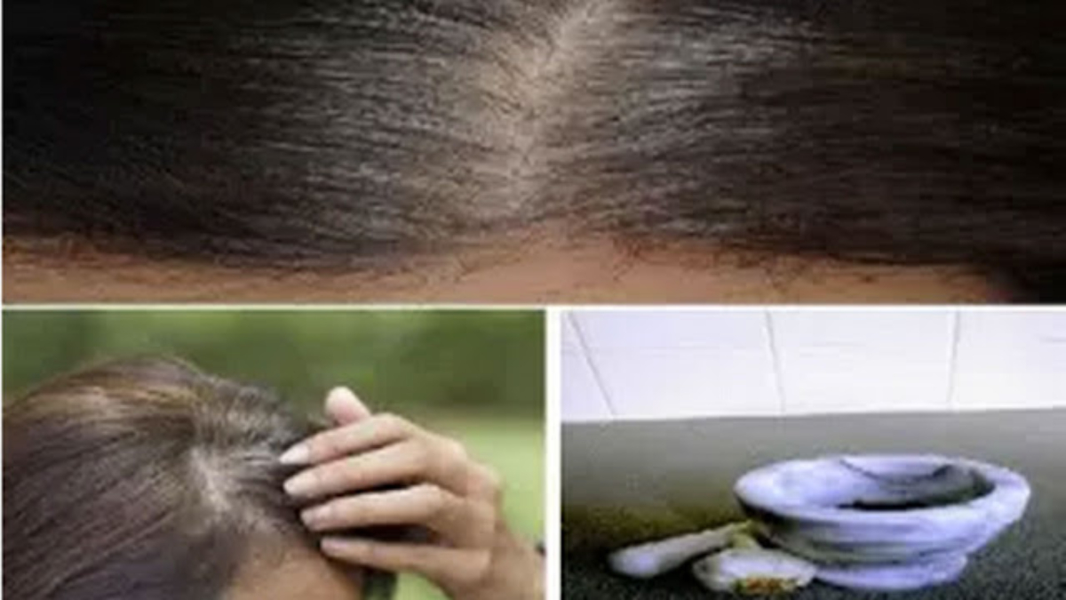 5-minutes-pour-se-d25C325A9barrasser-des-poils-blancs-et-la-repousse-des-cheveux-naturellement-