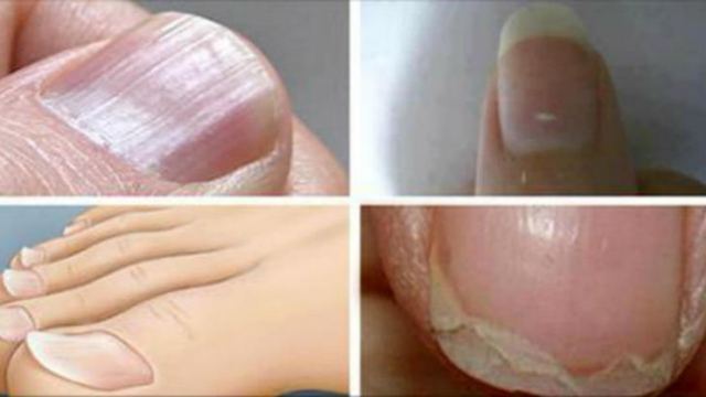 7CommunesConditionsd2527onglesli25C325A9sauxmaladiesgravesquinedevraientpas25C325AAtreignor25C325A92521