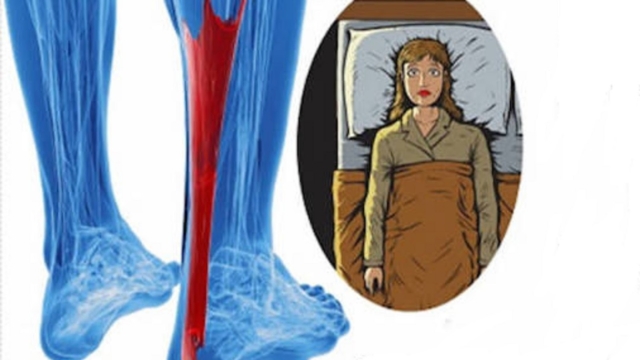 Commentpr25C325A9venirlescrampesauxjambes252Cetcommentneobtiendrezjamaiscescrampes