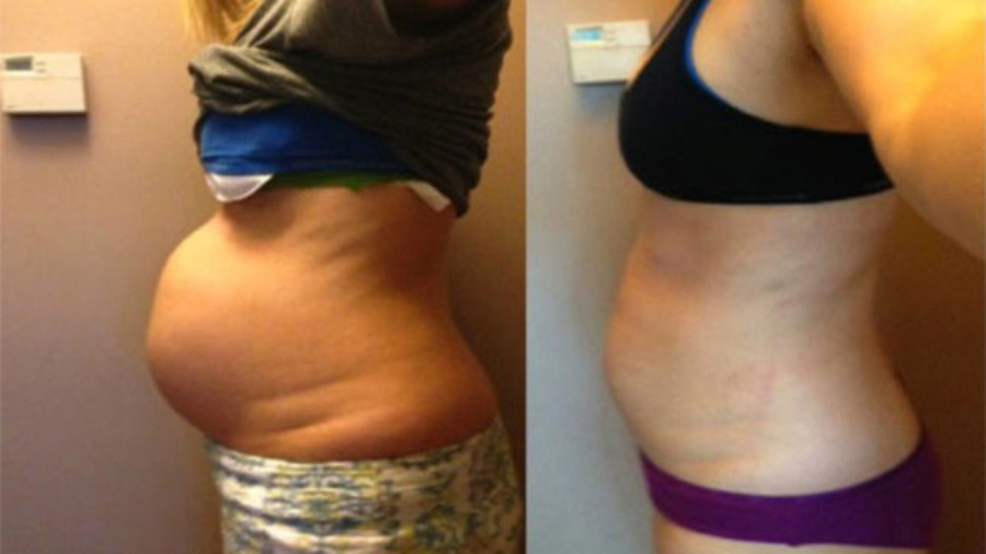 Perdre-du-poids-du-b25C325A9b25C325A9-Voici-Comment-perdre-du-poids-apr25C325A8s-la-grossesse2521