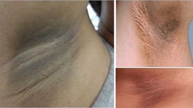 Rem25C325A8demaisonefficace1002525poursed25C325A9barrasserdesaissellessombresfacilement2521