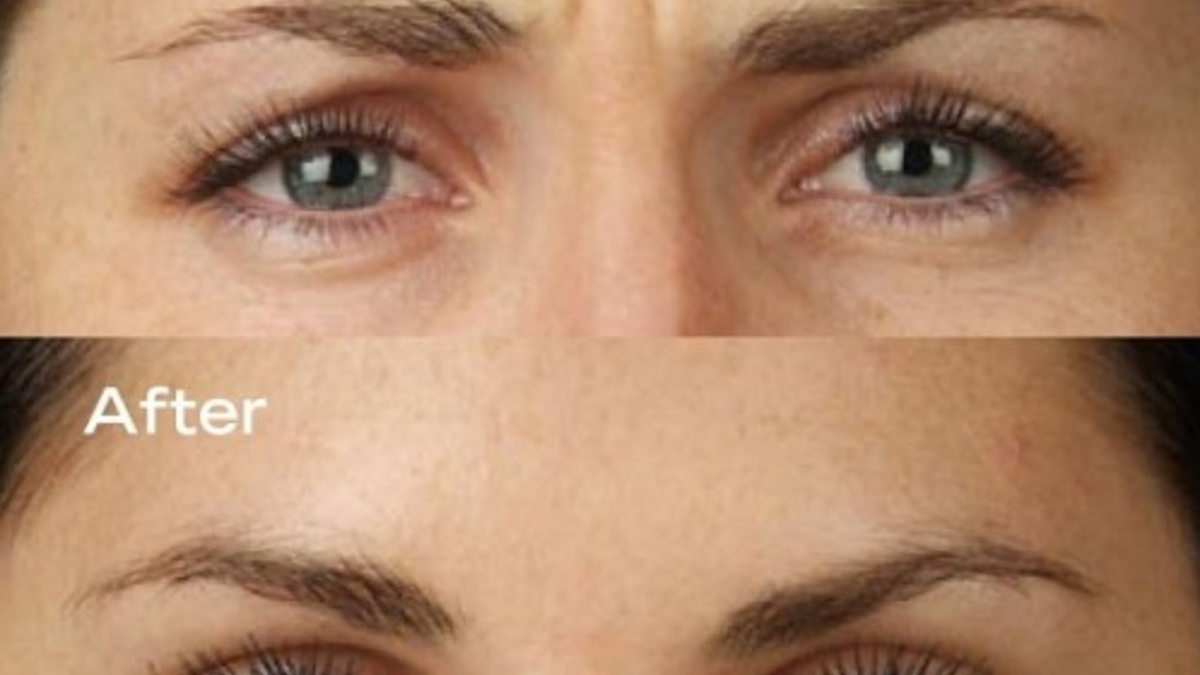 UneVieillerecettejaponaise252Cappliquezunefoisparsemaineetvousaurezl2527airde10ansplusjeune