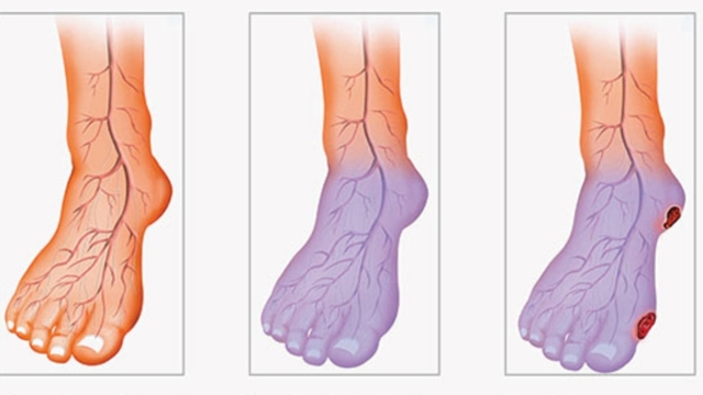 Voussouffrezd2527unemauvaisecirculation252CVoicicommentr25C325A9soudrevotreprobl25C325A8meenseulement20minutes2521