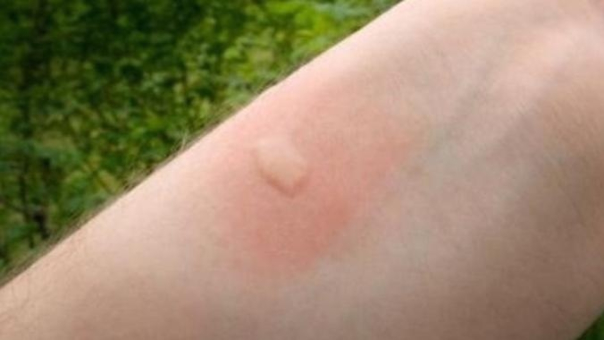 6rem25C325A8desnaturelspourlespiq25C325BBresdemoustiques