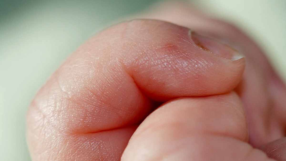 Battezlesinfectionsfongiquesdesonglesavecunseulproduit2521