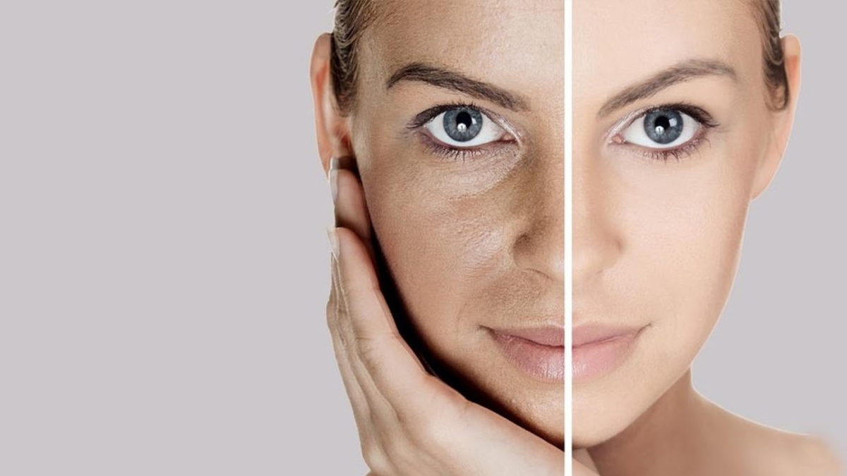 Commentnettoyervotrevisageetdesed25C325A9barrasserdescernessouslesyeuxavecunseulingr25C325A9dient