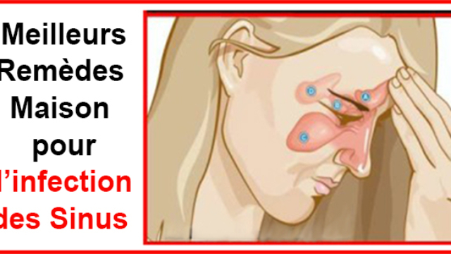 Commentpoursoulagervotreinfectiondessinusen20secondes