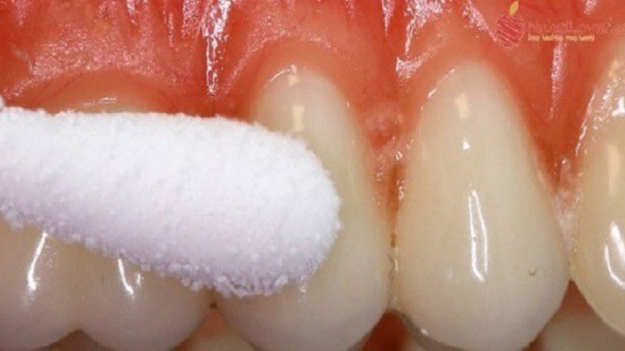 D25C325A9barrassez-vousdesmauxdedentsetsoulagerladouleur25C325A0lamaisonenquelquesminutes