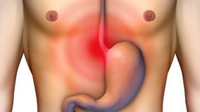 Voicicequevousdevezfairesivousavezdesprobl25C325A8mesdel2527estomac