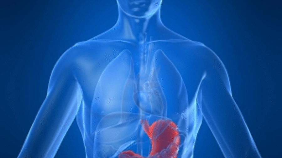 Voicicequevousdevezfairesivousavezdesprobl25C325A8mesdel2527estomac