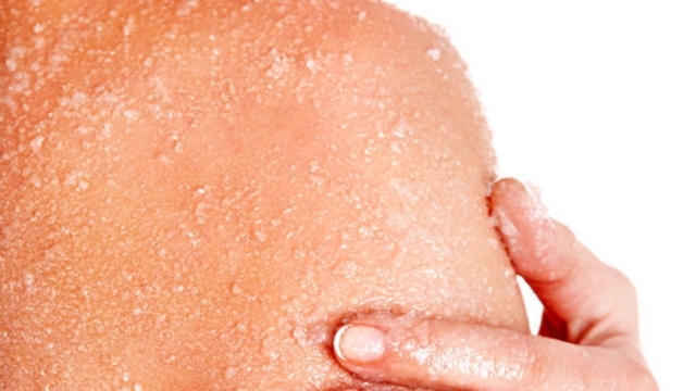 Rem25C325A8despopulairespourdesquamationdelapeau